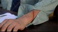 Peter's cut gives him away to Norman